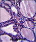 TRIM23 Antibody (N-term)